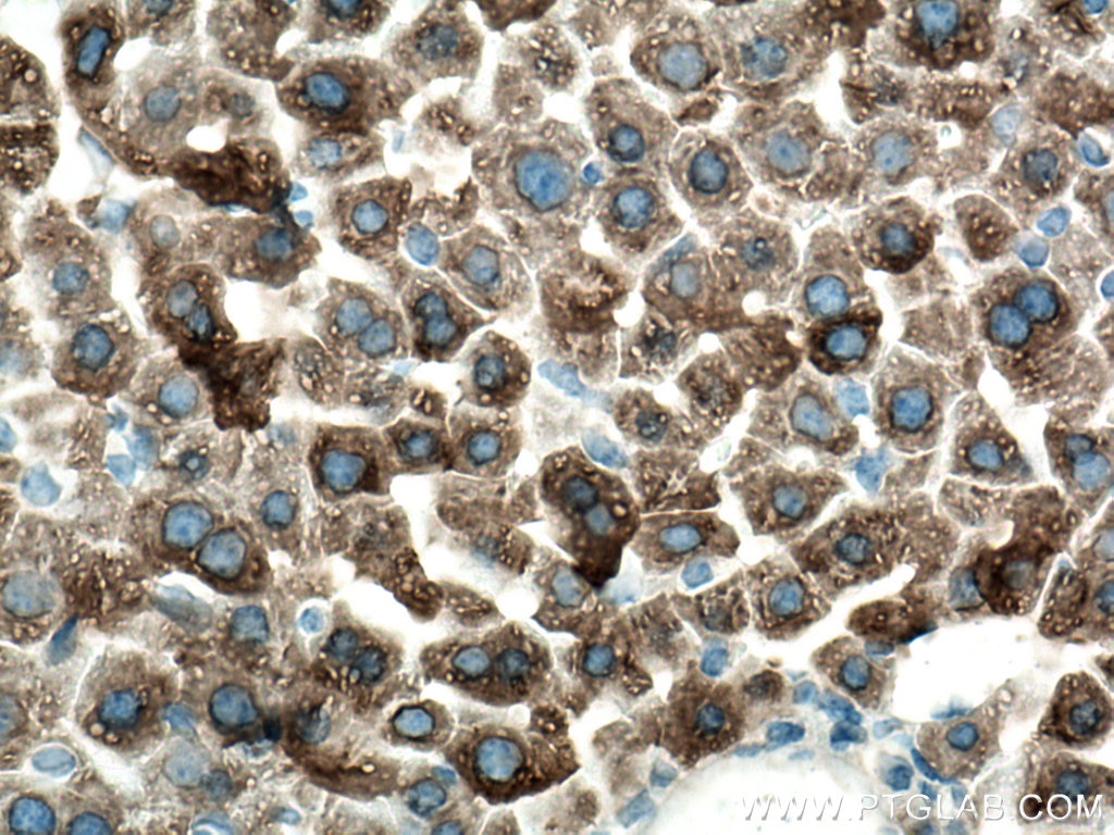 Immunohistochemistry (IHC) staining of mouse liver tissue using CYP3A4 Monoclonal antibody (67110-1-Ig)