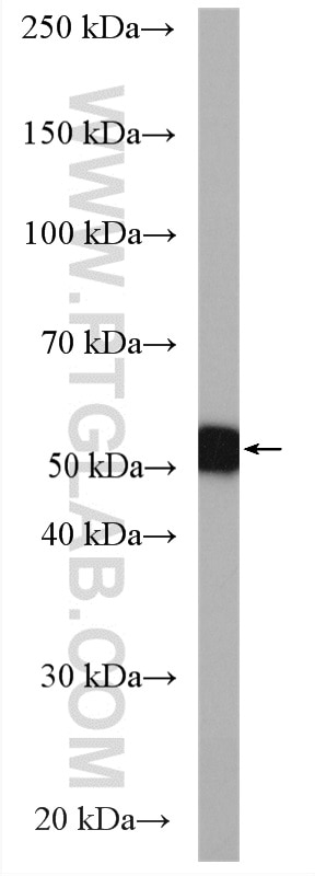Western Blot (WB) analysis of mouse liver tissue using CYP3A5 Polyclonal antibody (13737-1-AP)