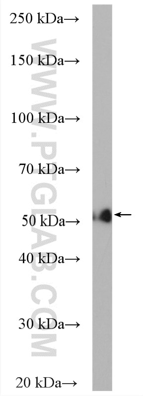 Western Blot (WB) analysis of mouse liver tissue using CYP3A5 Polyclonal antibody (13737-1-AP)