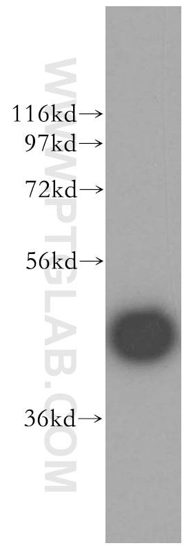 Western Blot (WB) analysis of human liver tissue using CYP3A5 Polyclonal antibody (13737-1-AP)
