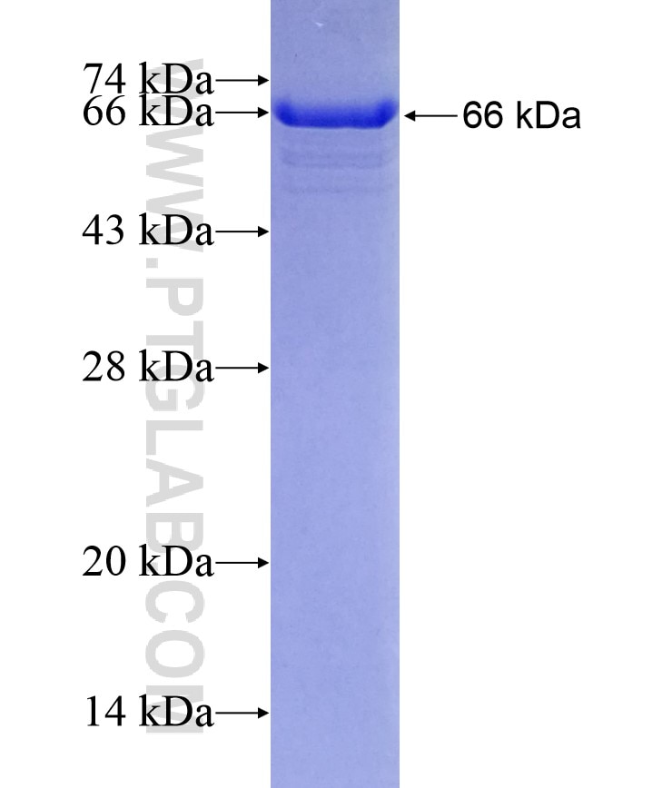 CYP3A5 fusion protein Ag4674 SDS-PAGE