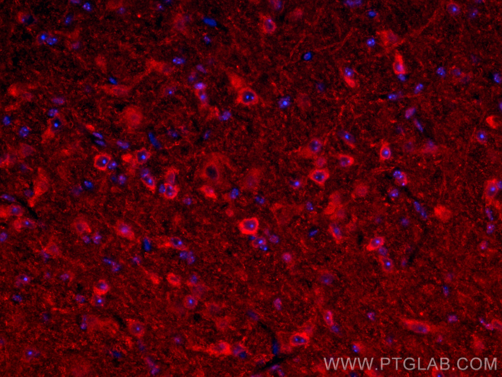 Immunofluorescence (IF) / fluorescent staining of mouse brain tissue using CYP46A1 Polyclonal antibody (12486-1-AP)
