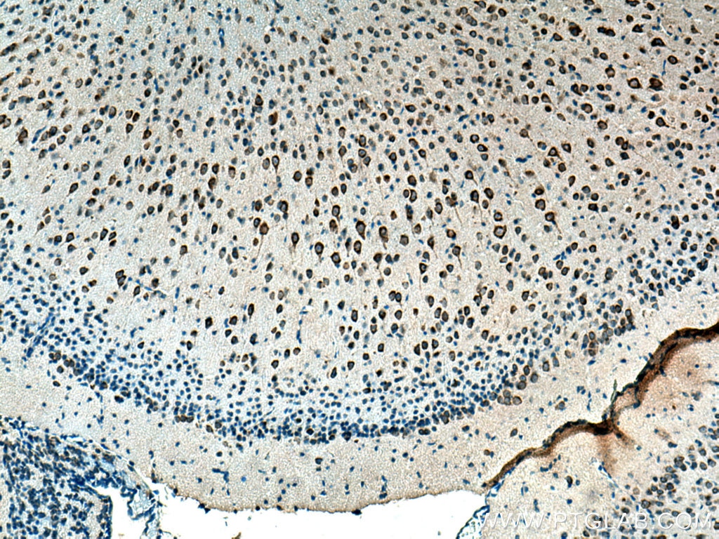 Immunohistochemistry (IHC) staining of mouse brain tissue using CYP46A1 Polyclonal antibody (12486-1-AP)