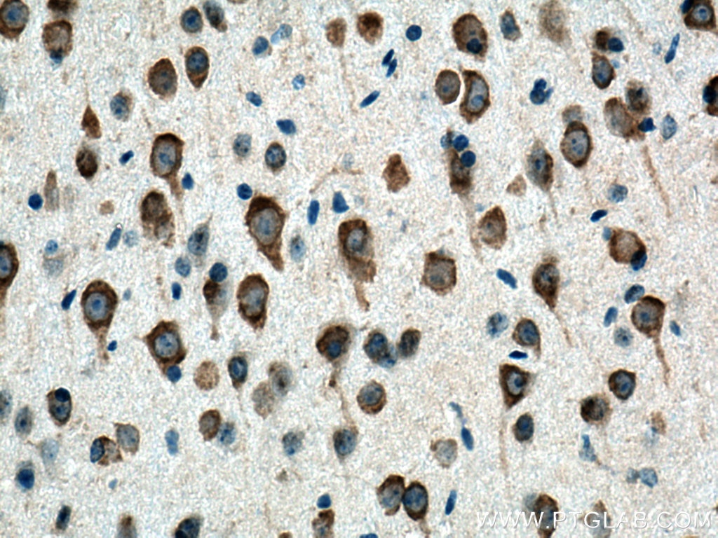 Immunohistochemistry (IHC) staining of mouse brain tissue using CYP46A1 Polyclonal antibody (12486-1-AP)