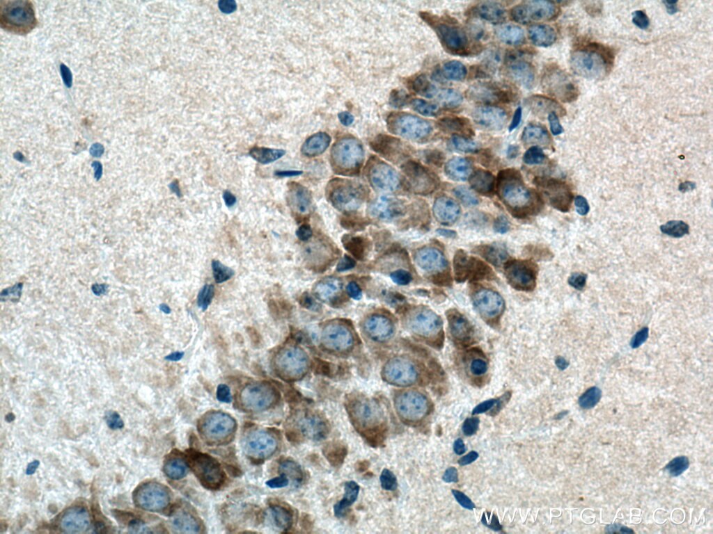 Immunohistochemistry (IHC) staining of mouse brain tissue using CYP46A1 Polyclonal antibody (12486-1-AP)