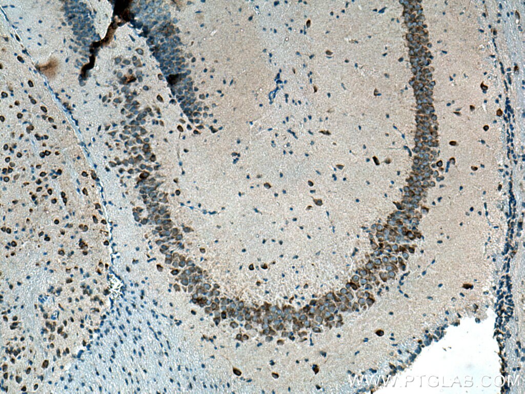 Immunohistochemistry (IHC) staining of mouse brain tissue using CYP46A1 Polyclonal antibody (12486-1-AP)