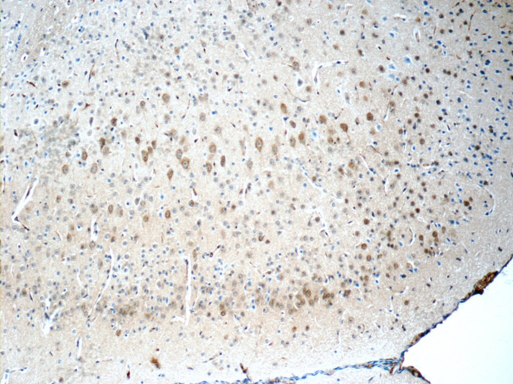 Immunohistochemistry (IHC) staining of mouse brain tissue using CYP46A1 Polyclonal antibody (12486-1-AP)