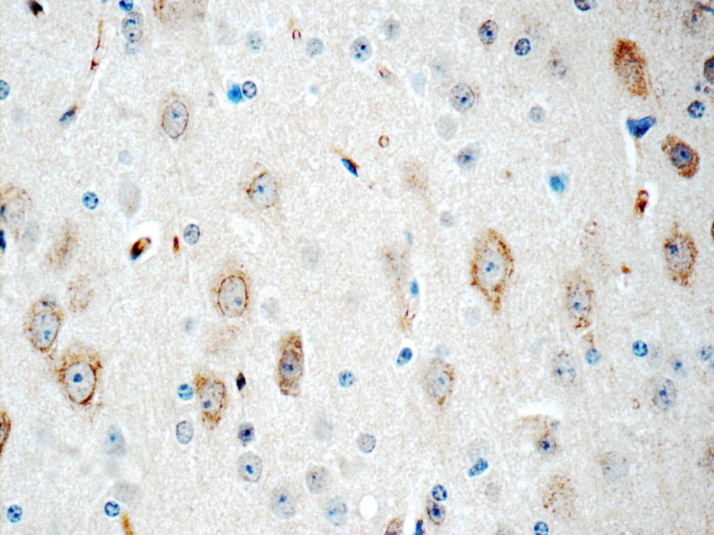 Immunohistochemistry (IHC) staining of mouse brain tissue using CYP46A1 Polyclonal antibody (12486-1-AP)