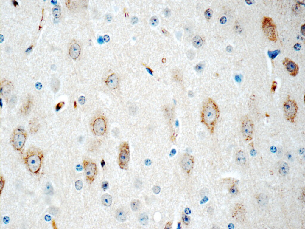 Immunohistochemistry (IHC) staining of mouse brain tissue using CYP46A1 Polyclonal antibody (12486-1-AP)