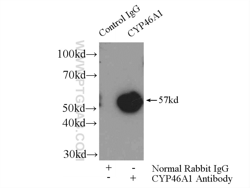 Immunoprecipitation (IP) experiment of mouse brain tissue using CYP46A1 Polyclonal antibody (12486-1-AP)