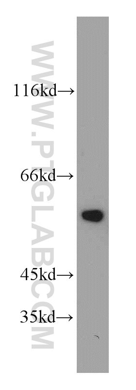 Western Blot (WB) analysis of mouse brain tissue using CYP46A1 Polyclonal antibody (12486-1-AP)