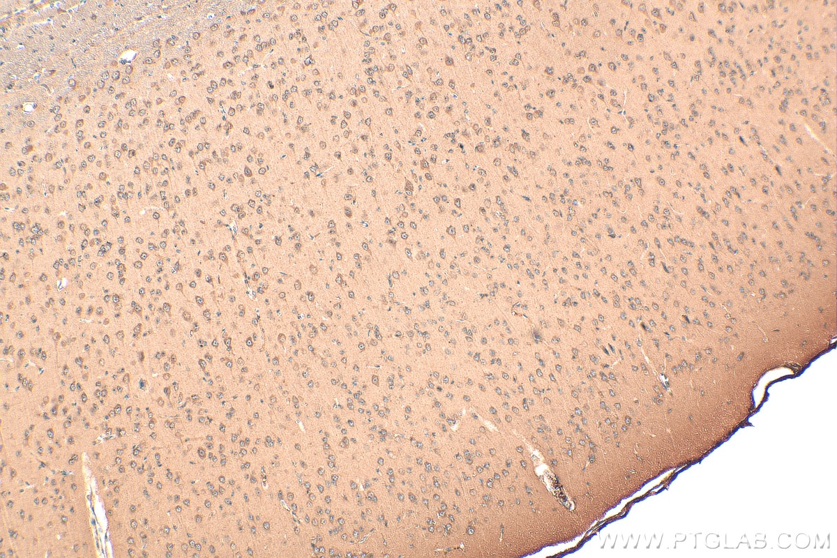 Immunohistochemistry (IHC) staining of mouse brain tissue using CYP46A1 Monoclonal antibody (68576-1-Ig)