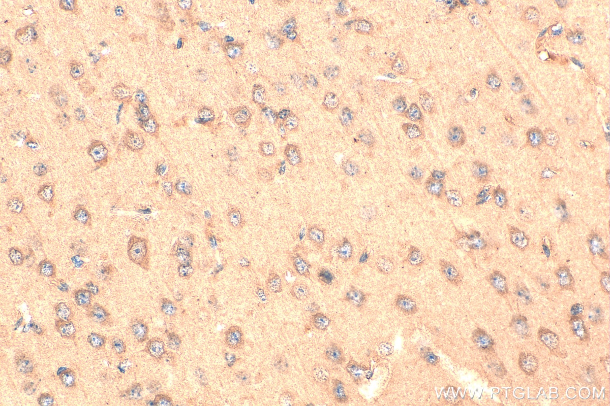 Immunohistochemistry (IHC) staining of mouse brain tissue using CYP46A1 Monoclonal antibody (68576-1-Ig)