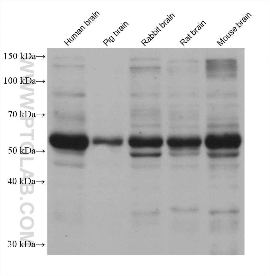 Western Blot (WB) analysis of various lysates using CYP46A1 Monoclonal antibody (68576-1-Ig)