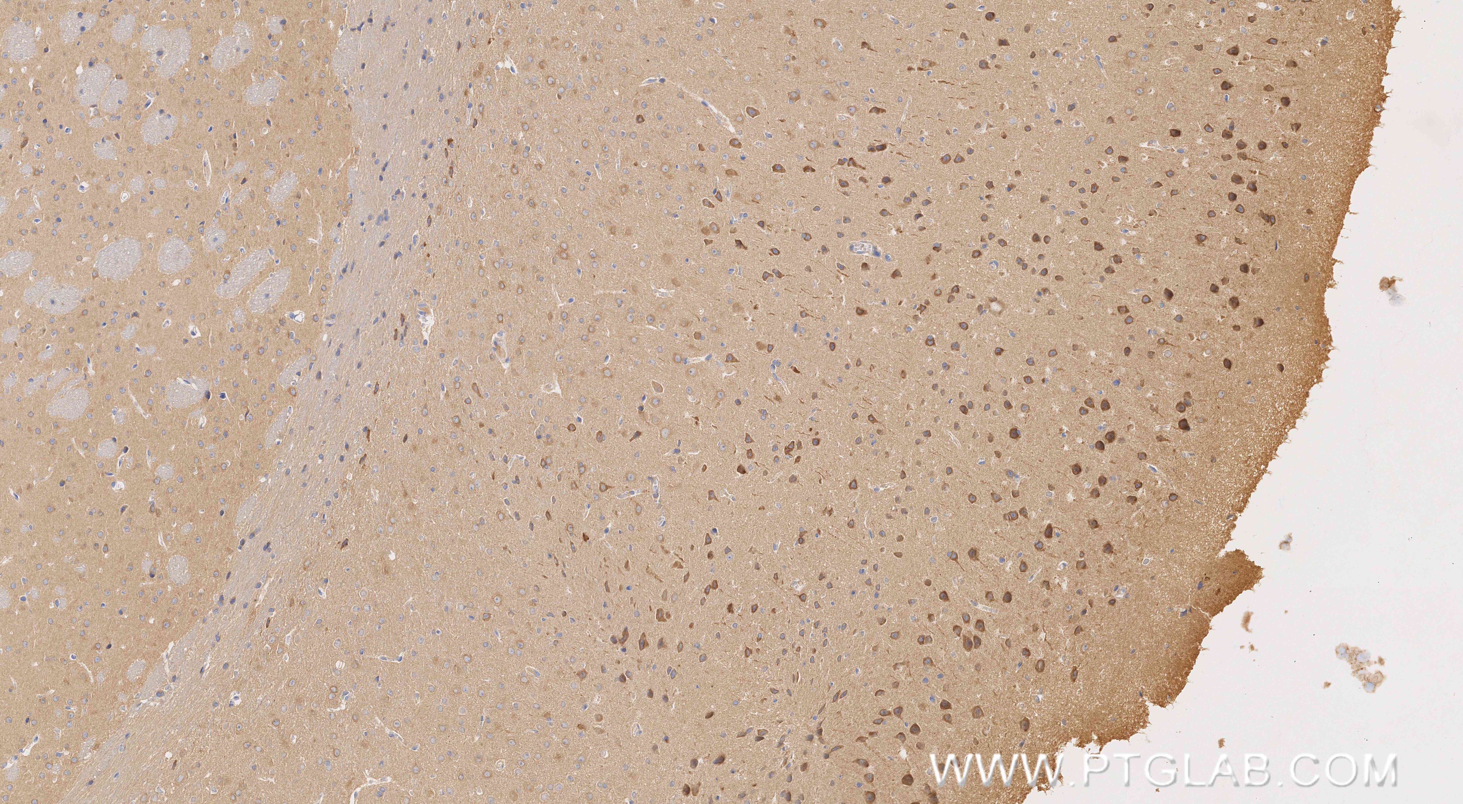IHC staining of mouse brain using 86957-1-RR (same clone as 86957-1-PBS) Immunohistochemistry (IHC) staining of mouse brain tissue using CYP46A1 Recombinant monoclonal antibody (86957-1-RR)