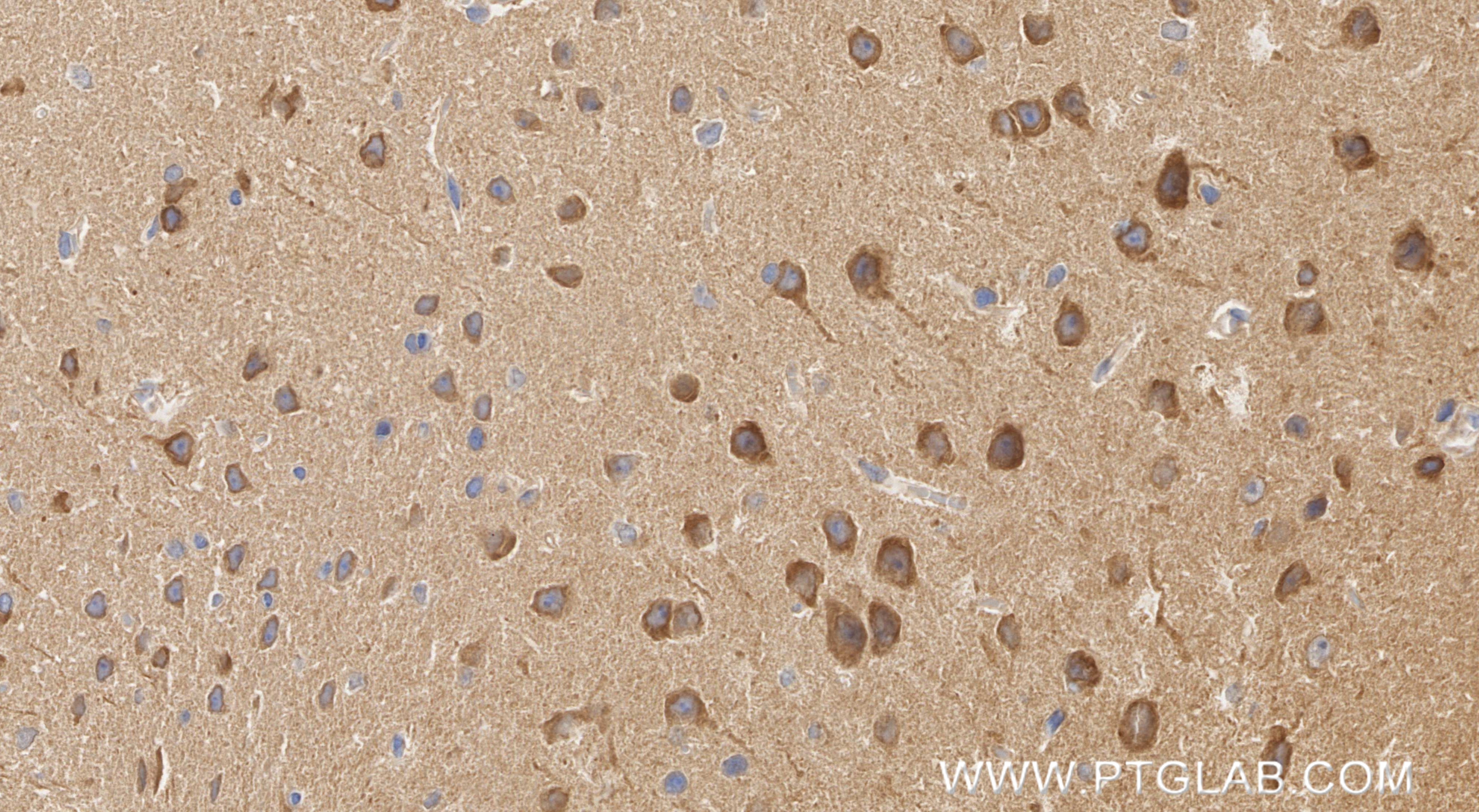 IHC staining of mouse brain using 86957-1-RR (same clone as 86957-1-PBS) Immunohistochemistry (IHC) staining of mouse brain tissue using CYP46A1 Recombinant monoclonal antibody (86957-1-RR)
