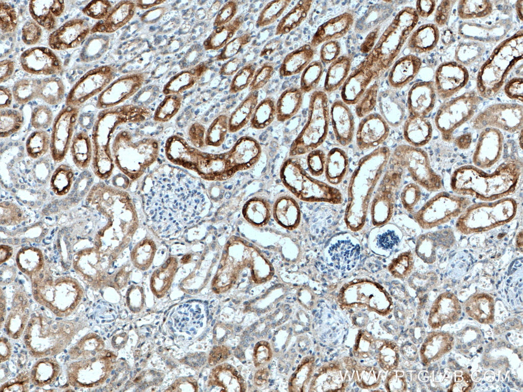 Immunohistochemistry (IHC) staining of human kidney tissue using CYP4A11 Polyclonal antibody (11688-1-AP)