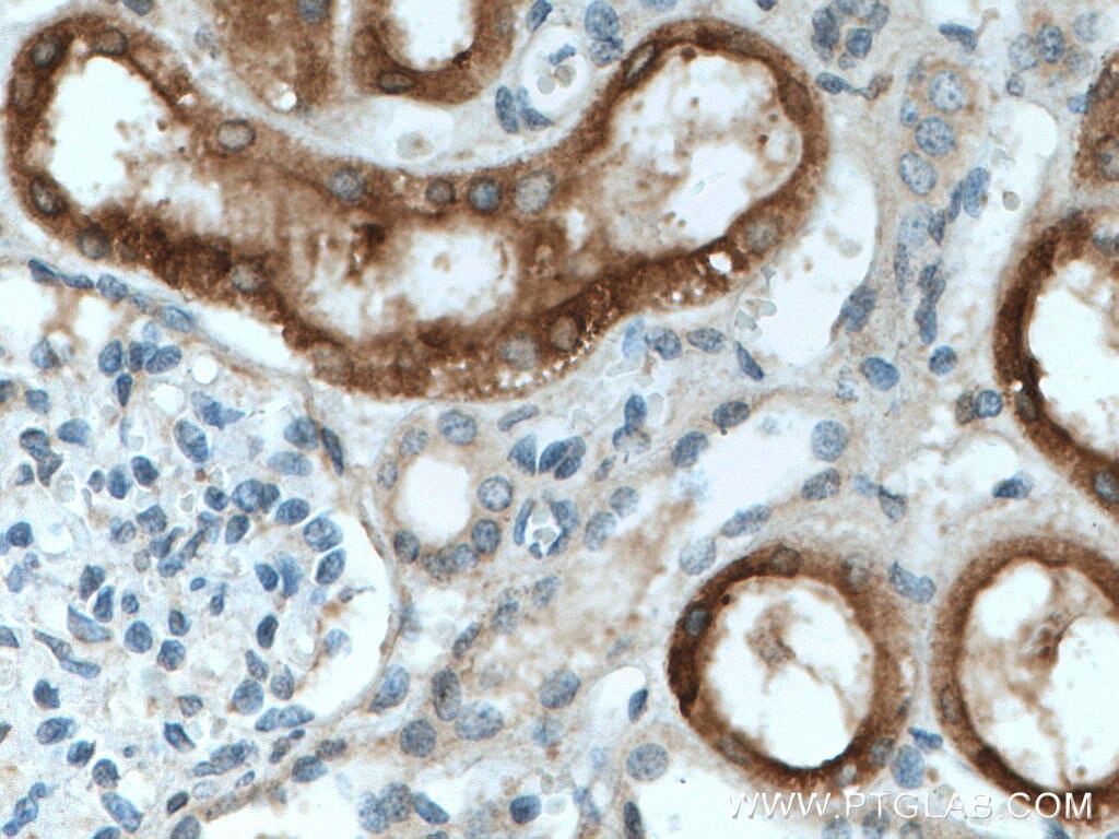 Immunohistochemistry (IHC) staining of human kidney tissue using CYP4A11 Polyclonal antibody (11688-1-AP)