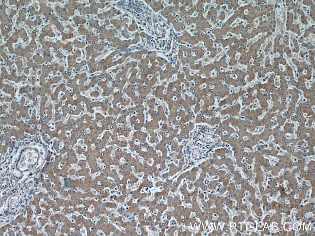 IHC staining of human liver using 11688-1-AP