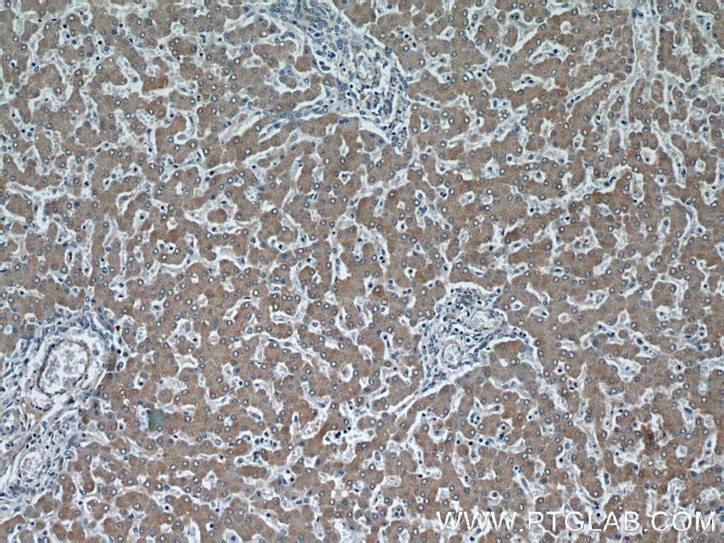 Immunohistochemistry (IHC) staining of human liver tissue using CYP4A11 Polyclonal antibody (11688-1-AP)