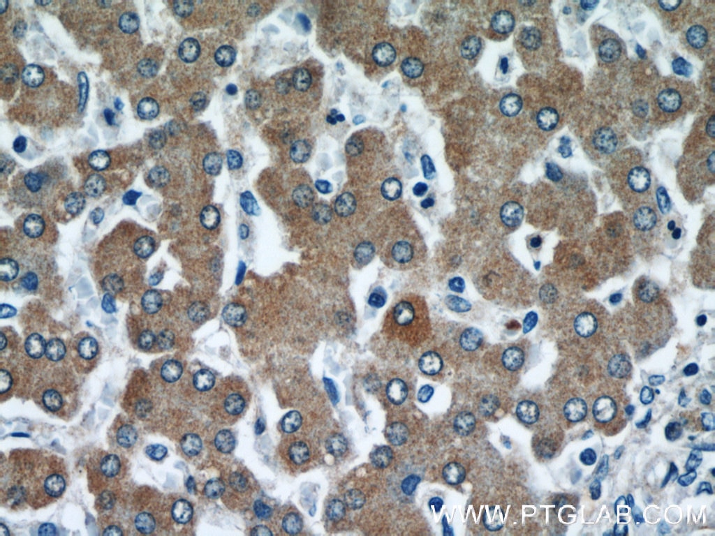 Immunohistochemistry (IHC) staining of human liver tissue using CYP4A11 Polyclonal antibody (11688-1-AP)