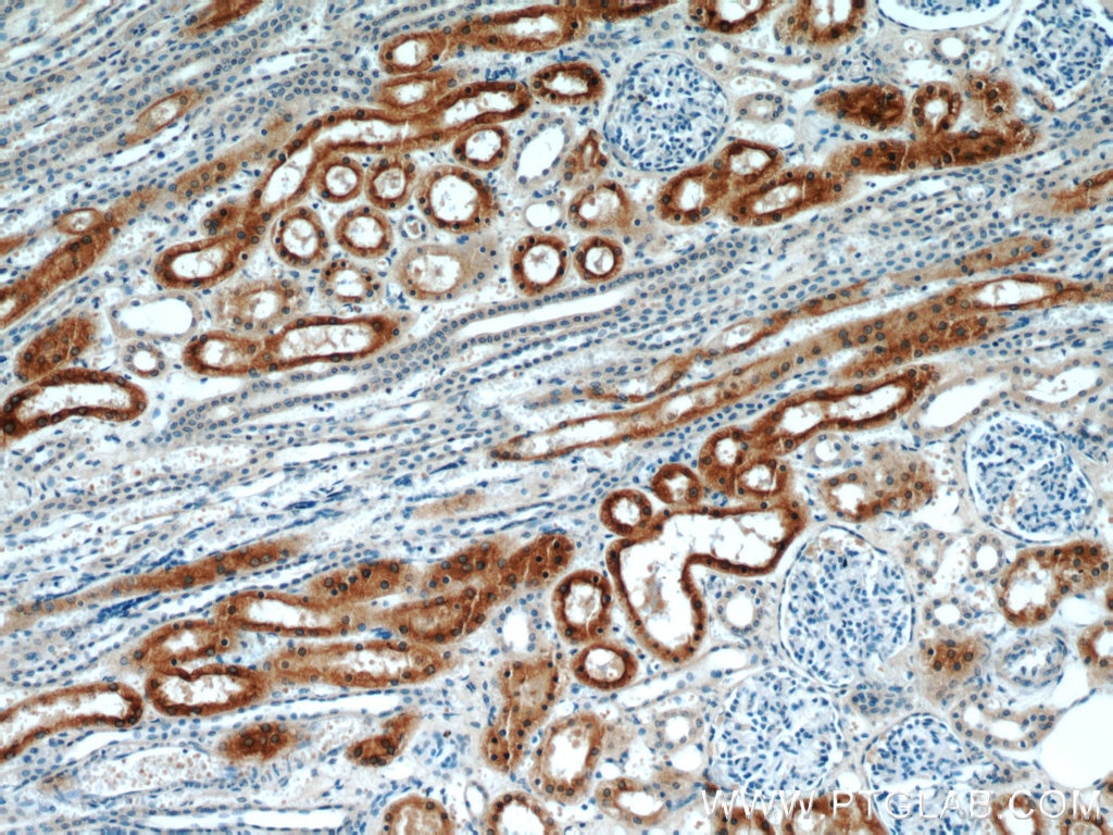 Immunohistochemistry (IHC) staining of human kidney tissue using CYP4A11 Polyclonal antibody (11688-1-AP)