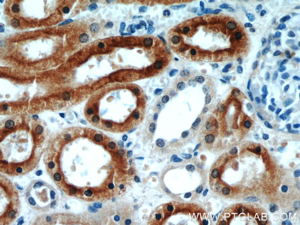 Immunohistochemistry (IHC) staining of human kidney tissue using CYP4A11 Polyclonal antibody (11688-1-AP)