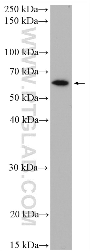 Western Blot (WB) analysis of HEK-293 cells using CYP4A11 Polyclonal antibody (11688-1-AP)
