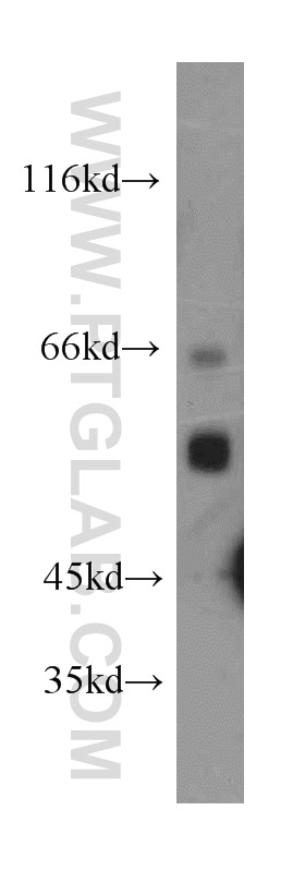Western Blot (WB) analysis of rat kidney tissue using CYP4A11 Polyclonal antibody (11688-1-AP)