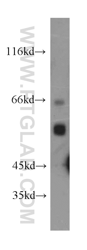 WB analysis of rat kidney using 11688-1-AP