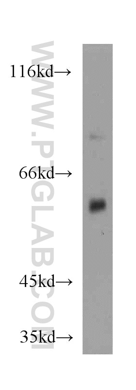 Western Blot (WB) analysis of mouse kidney tissue using CYP4A11 Polyclonal antibody (11688-1-AP)