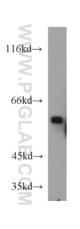 Western Blot (WB) analysis of mouse kidney tissue using CYP4A11 Polyclonal antibody (11688-1-AP)