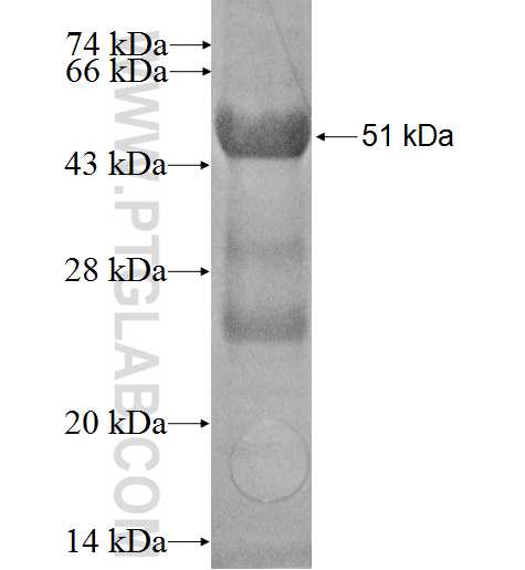 CYP4A11 fusion protein Ag2300 SDS-PAGE