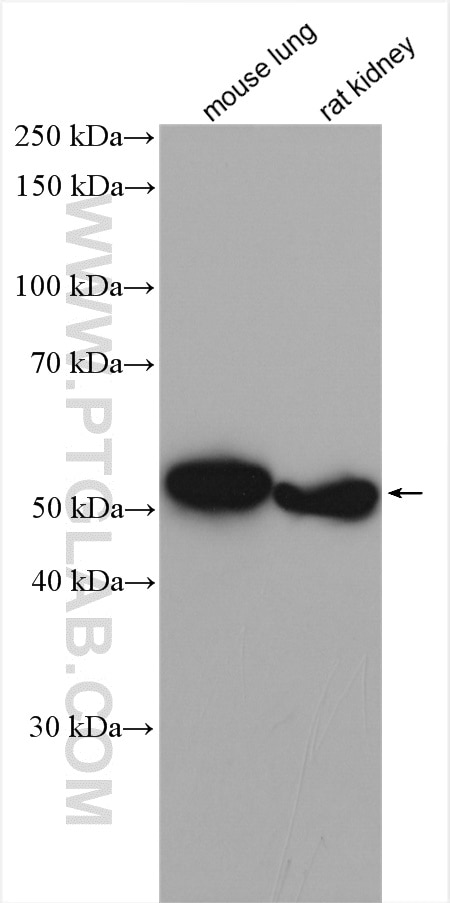 Western Blot (WB) analysis of various lysates using CYP4B1 Polyclonal antibody (11771-1-AP)