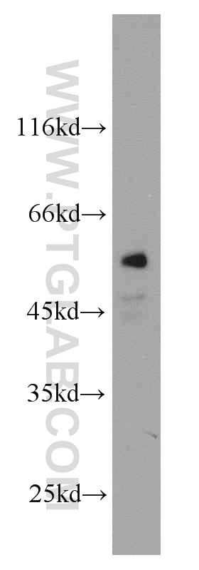 Western Blot (WB) analysis of A549 cells using CYP4B1 Polyclonal antibody (11771-1-AP)