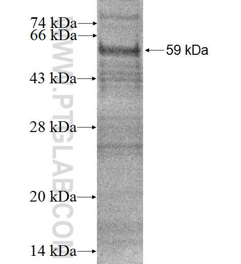 CYP4B1 fusion protein Ag2416 SDS-PAGE