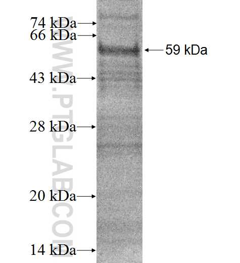 CYP4B1 fusion protein Ag2416 SDS-PAGE