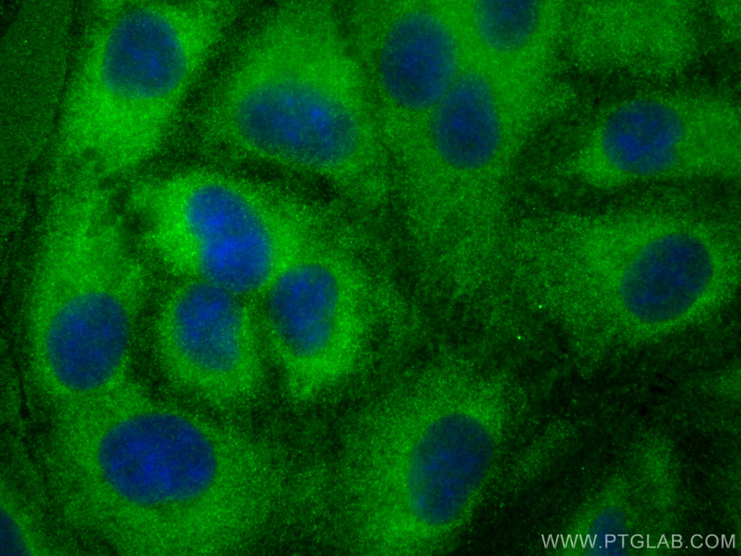 Immunofluorescence (IF) / fluorescent staining of A549 cells using CYP4F11 Polyclonal antibody (12286-1-AP)
