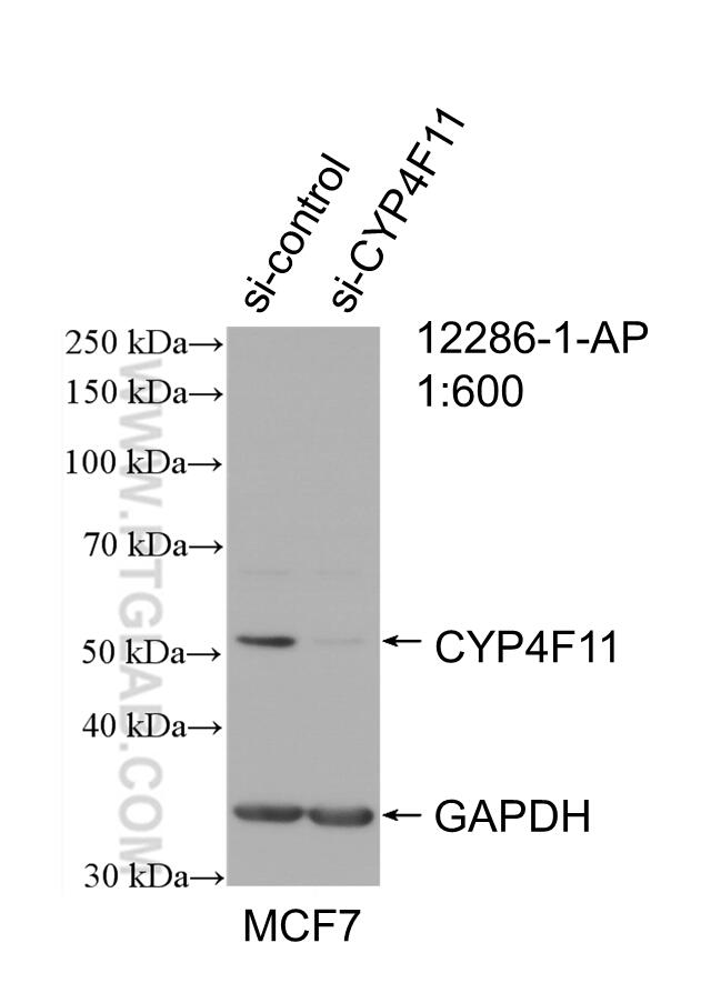 Western Blot (WB) analysis of MCF-7 cells using CYP4F11 Polyclonal antibody (12286-1-AP)