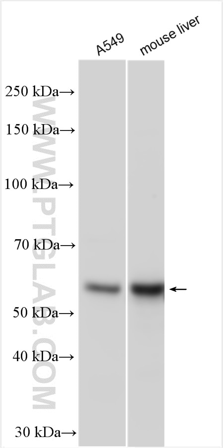 Western Blot (WB) analysis of various lysates using CYP4F11 Polyclonal antibody (12286-1-AP)