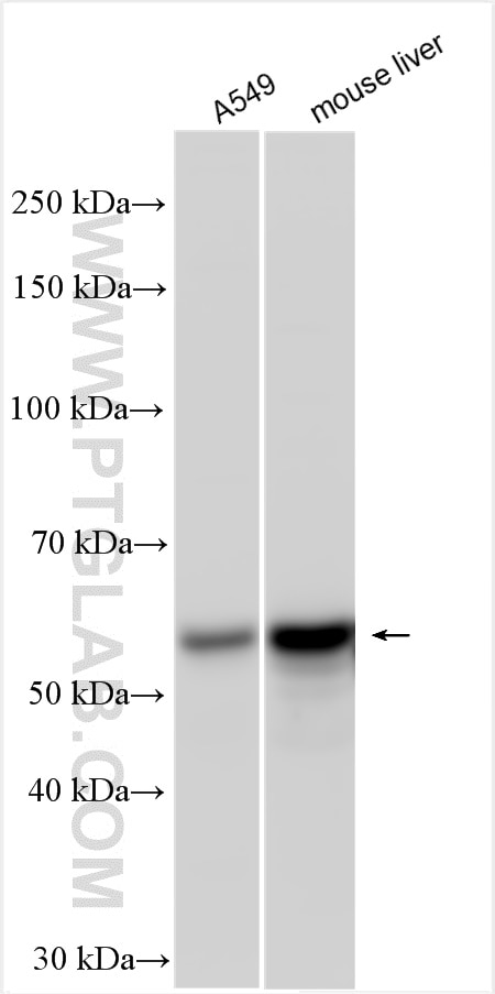 Western Blot (WB) analysis of various lysates using CYP4F11 Polyclonal antibody (12286-1-AP)