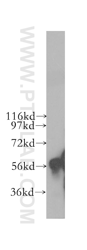 Western Blot (WB) analysis of human liver tissue using CYP4F11 Polyclonal antibody (12286-1-AP)
