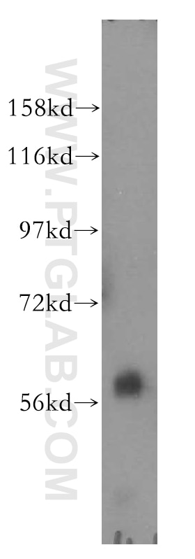 Western Blot (WB) analysis of human liver tissue using CYP4F11 Polyclonal antibody (12286-1-AP)