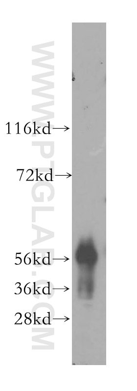 Western Blot (WB) analysis of human kidney tissue using CYP4F11 Polyclonal antibody (12286-1-AP)
