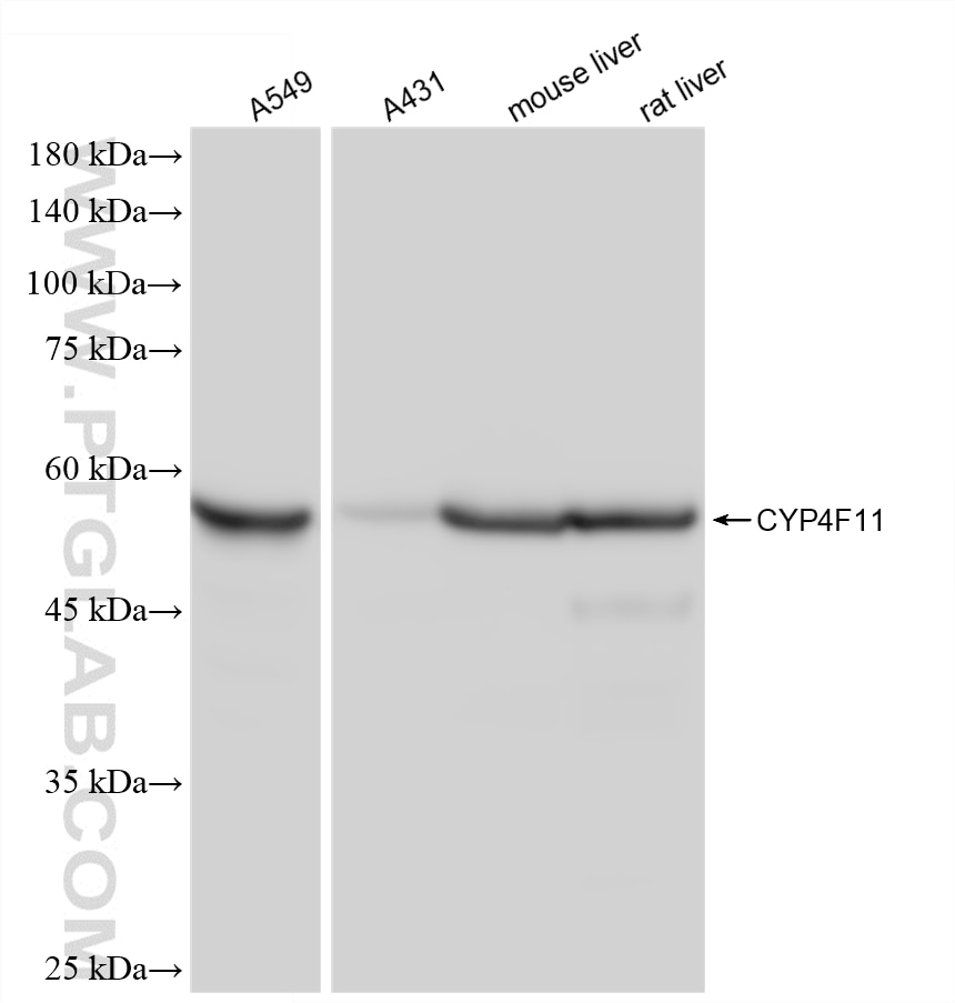 WB analysis using 88260-1-RR (same clone as 88260-1-PBS) Western Blot (WB) analysis of various lysates using CYP4F11 Recombinant monoclonal antibody (88260-1-RR)