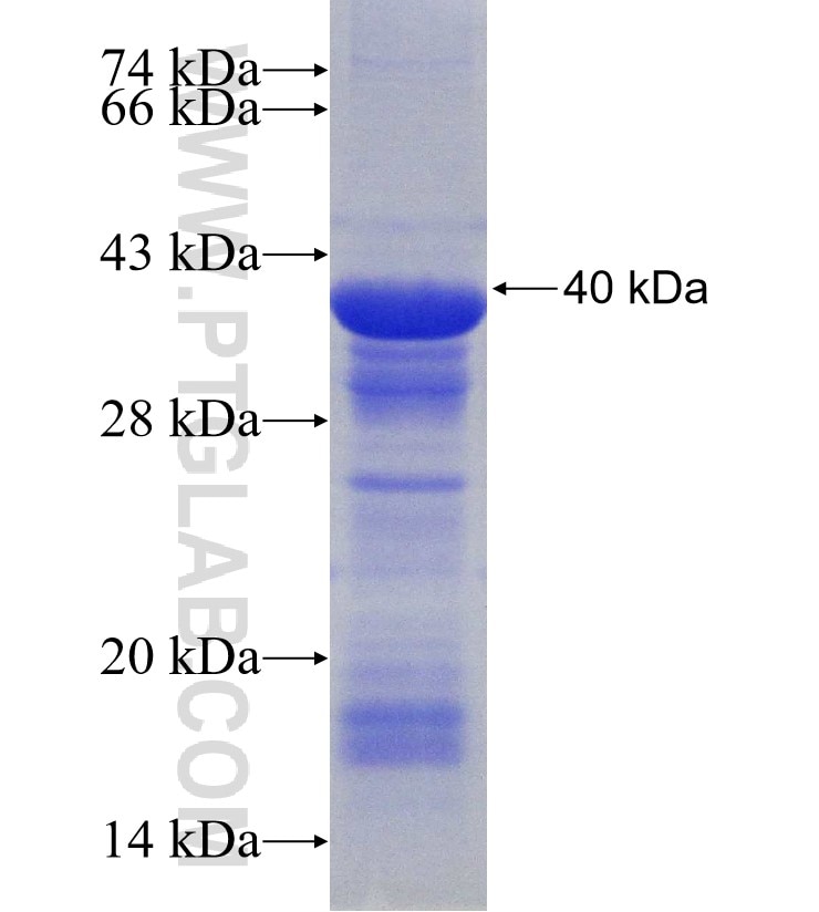 CYP4F11 fusion protein Ag30792 SDS-PAGE