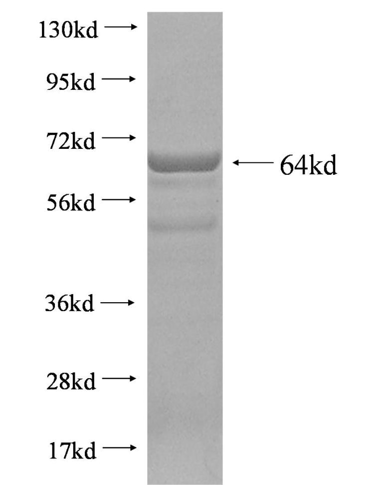 CYP4F11 fusion protein Ag2906 SDS-PAGE