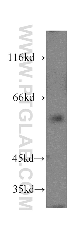 CYP4F11-Specific