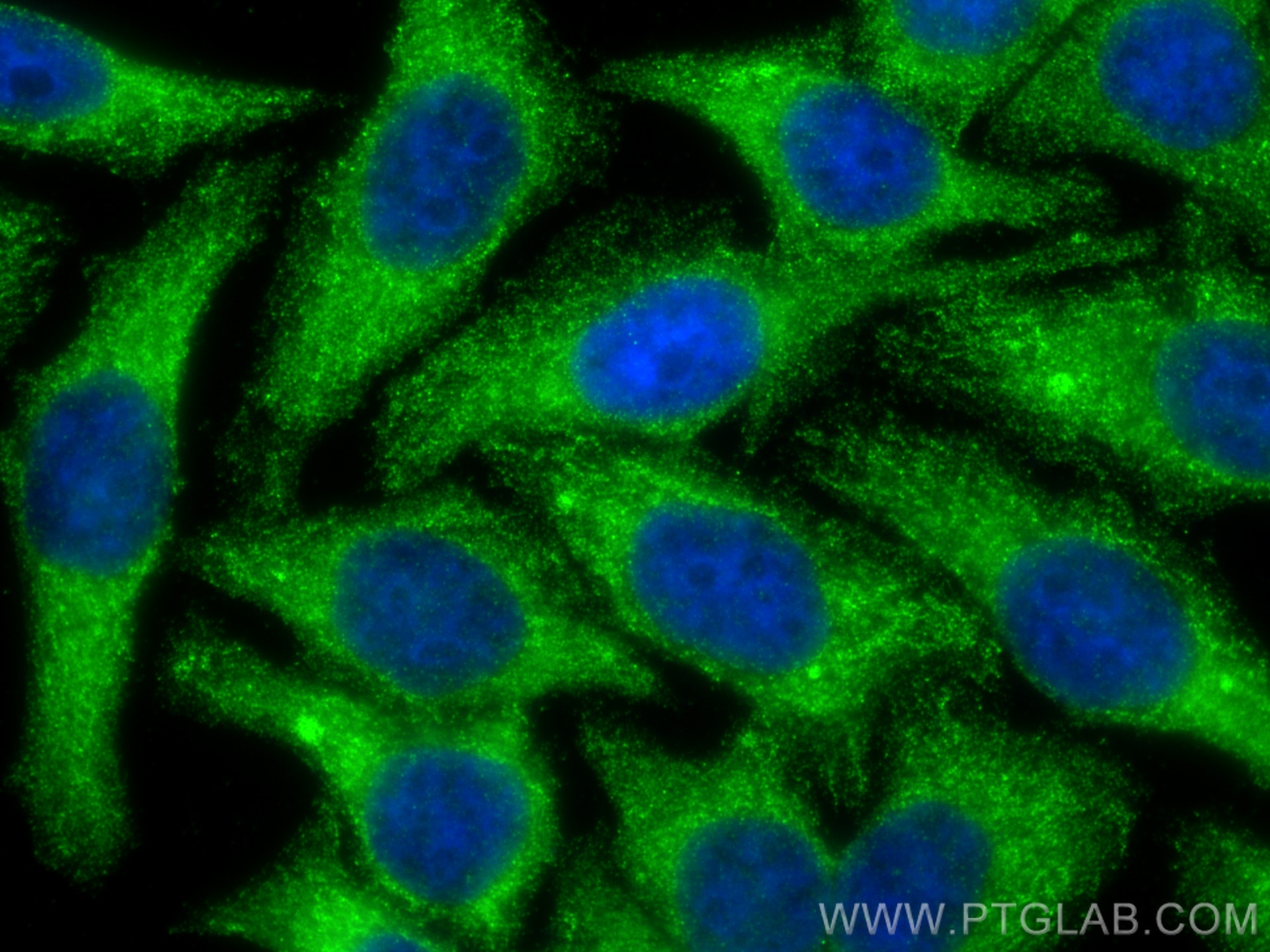 Immunofluorescence (IF) / fluorescent staining of HepG2 cells using CYP4F12 Polyclonal antibody (13243-1-AP)
