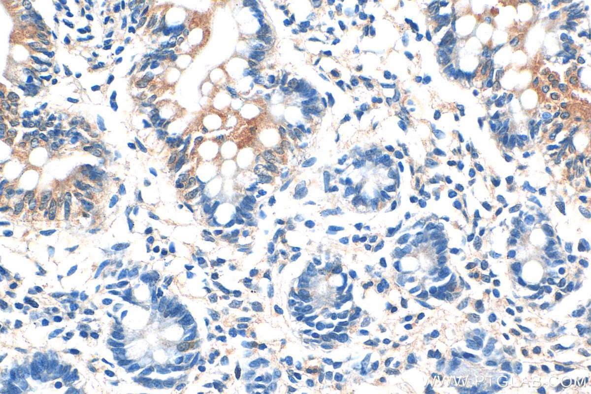 Immunohistochemistry (IHC) staining of human small intestine tissue using CYP4F12 Polyclonal antibody (13243-1-AP)